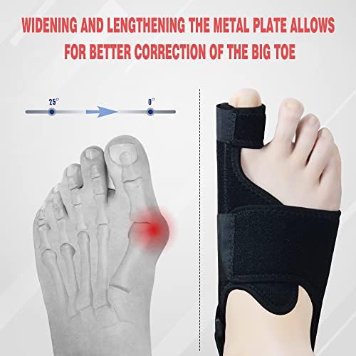 MOONSMILE 1 Pair Foot Bunion Corrector for Women & Men, Night Bunion Splint, Big Toe Straightener, Foot Gear Bunion Brace for Pain Relief