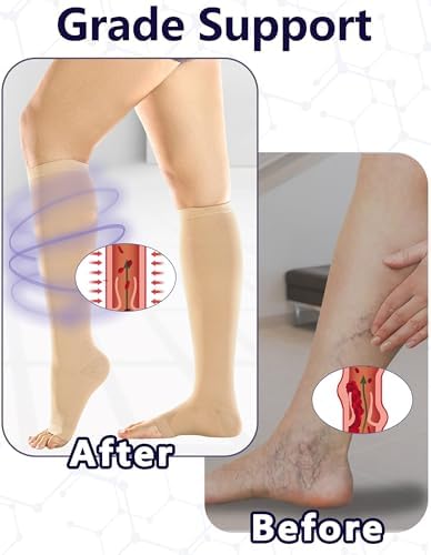 +MD 2 Pairs 20-30 mmHg Compression Socks for Women & Men, Knee High Open Toe Stockings, Graduated Support & Comfort Hose