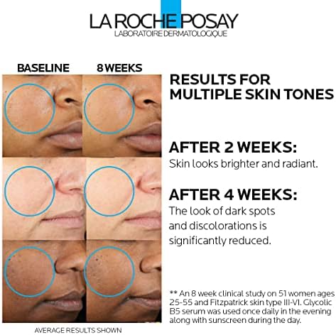 La Roche-Posay Glycolic Acid Dark Spot Serum with Vitamin B5, 1oz