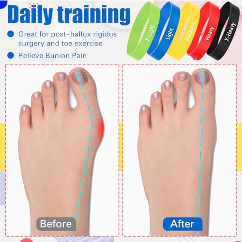 WinnerWhy 5 Pack Toe Exercise Bands Stretcher Separator Spacer,Multicolor