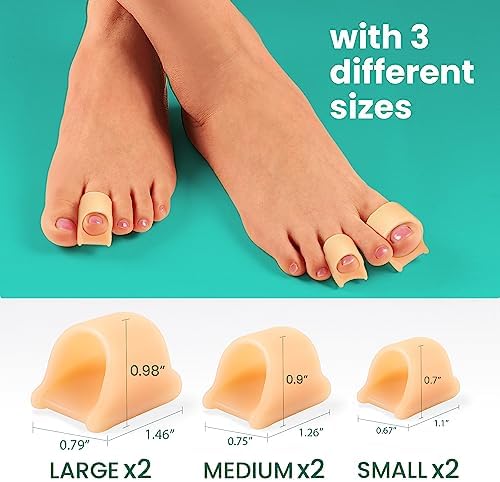 Welnove Hammertoe Corrector - 6 Pack Toe Splints - Soft Gel Toe Straighteners - Realign Bent, Curled, Crooked, Claw, Hammer Toes - Toe Corrector for Men and Women, 3 Different Sizes (Beige)