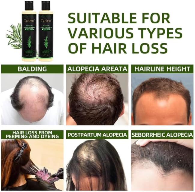Tgideas Rosemary Biotin Volumizing Shampoo for Thinning Hair, 7.4 Fl Oz