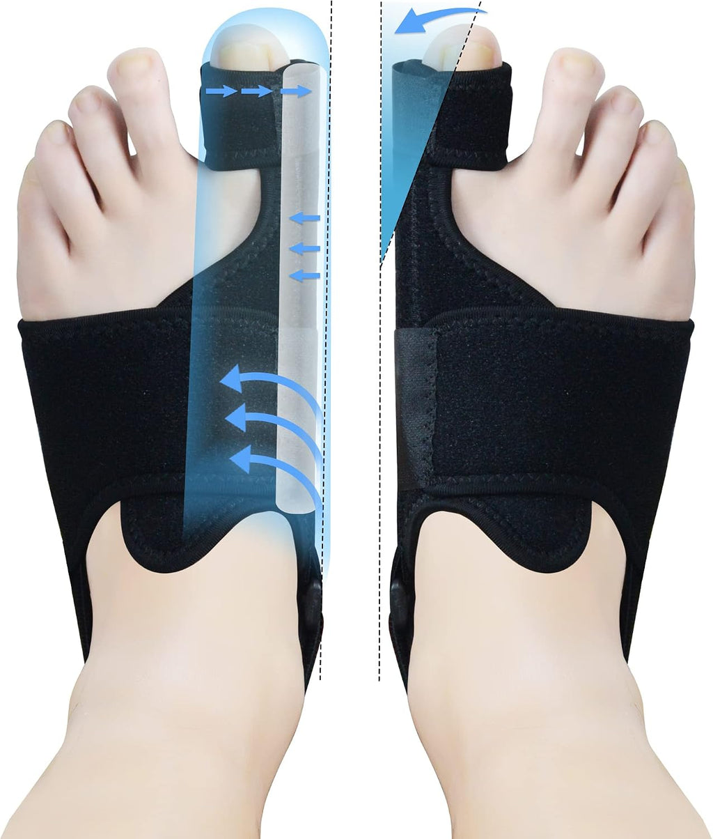 MOONSMILE 1 Pair Foot Bunion Corrector for Women & Men, Night Bunion Splint, Big Toe Straightener, Foot Gear Bunion Brace for Pain Relief
