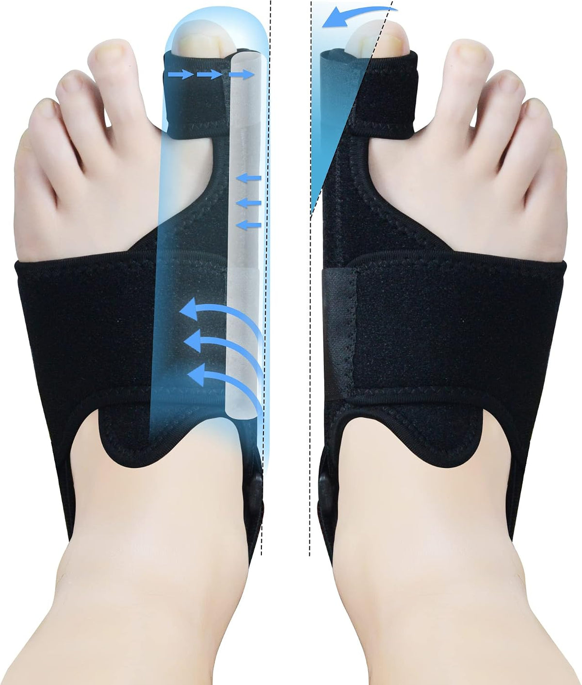 MOONSMILE 1 Pair Foot Bunion Corrector for Women & Men, Night Bunion Splint, Big Toe Straightener, Foot Gear Bunion Brace for Pain Relief