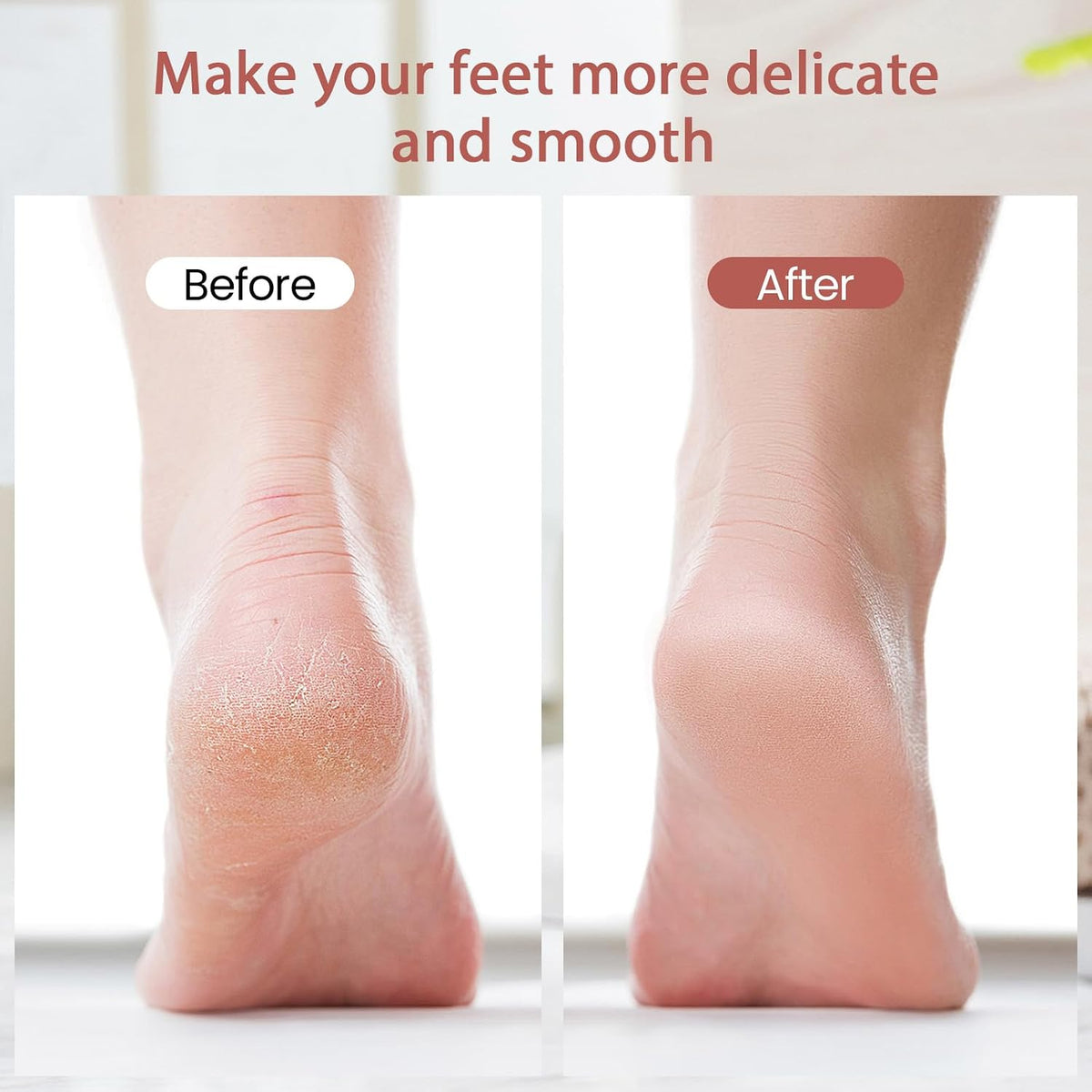 ZABOUL Callus Removers for Feet, Electric Foot Callus Remover Rechargeable with 2 Roller Heads Electronic Foot File Removes Hard Skin for Soft Beautiful Feet, Feet Care Pedicure Tools