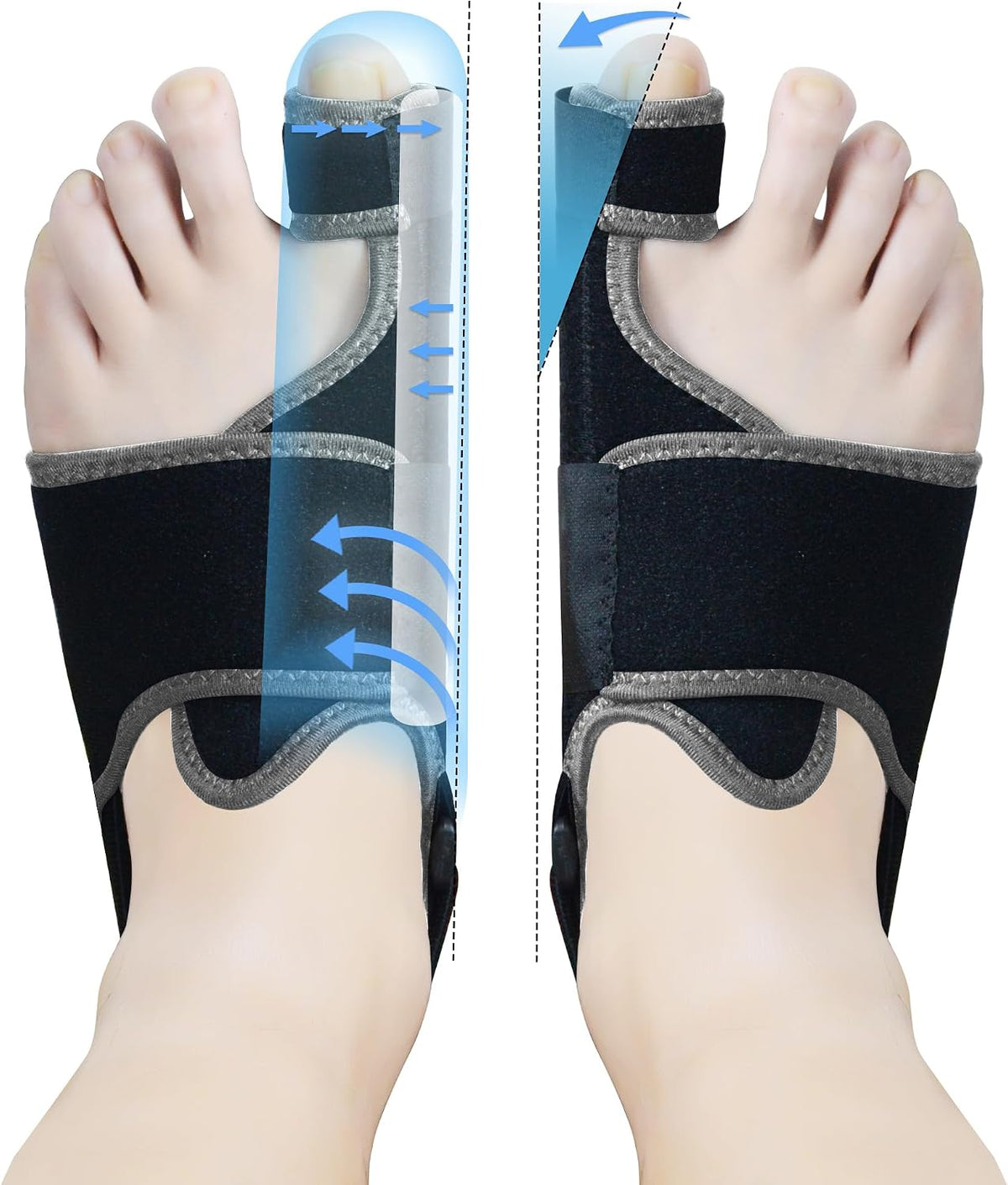 MOONSMILE 1 Pair Foot Bunion Corrector for Women & Men, Night Bunion Splint, Big Toe Straightener, Foot Gear Bunion Brace for Pain Relief